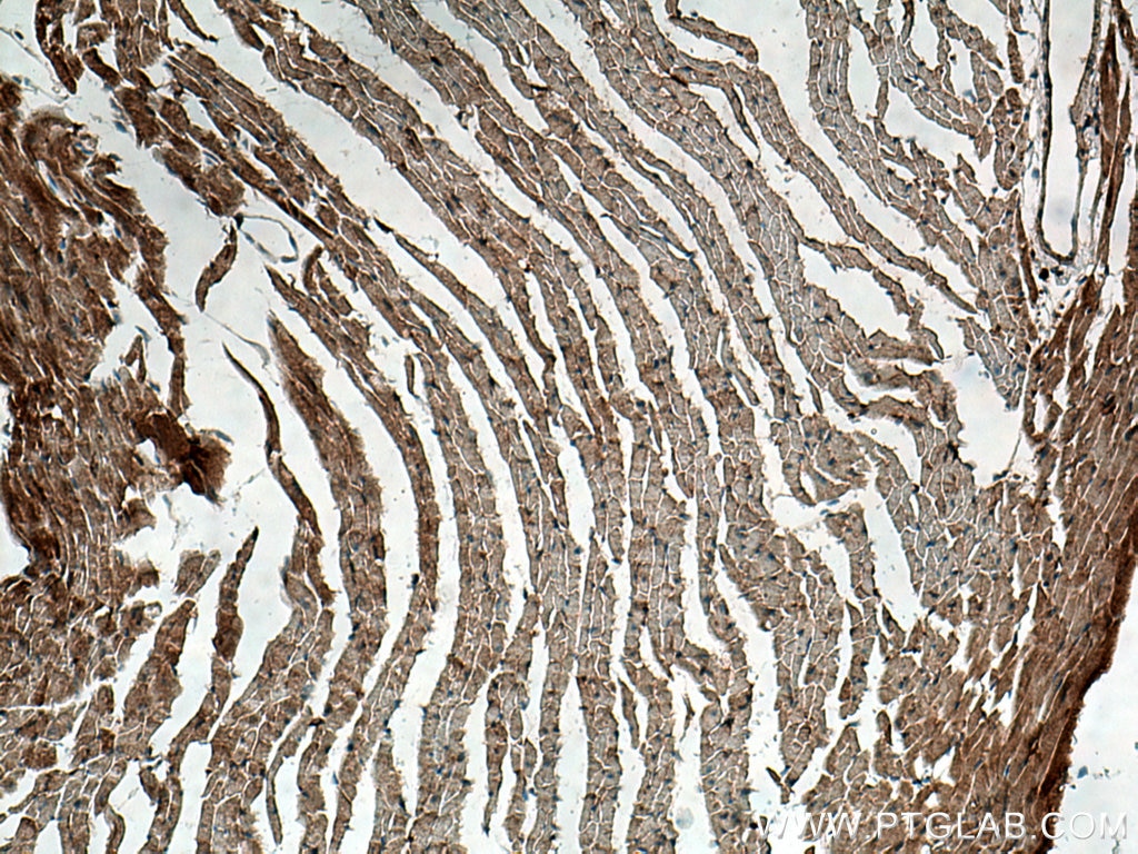 Immunohistochemistry (IHC) staining of mouse heart tissue using MFN2 Polyclonal antibody (28341-1-AP)