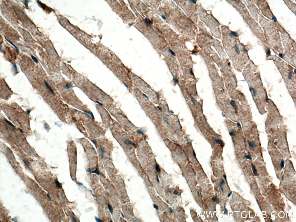 IHC staining of mouse heart using 28341-1-AP