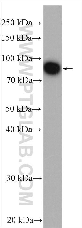 Western Blot (WB) analysis of HepG2 cells using MFN2 Polyclonal antibody (28341-1-AP)