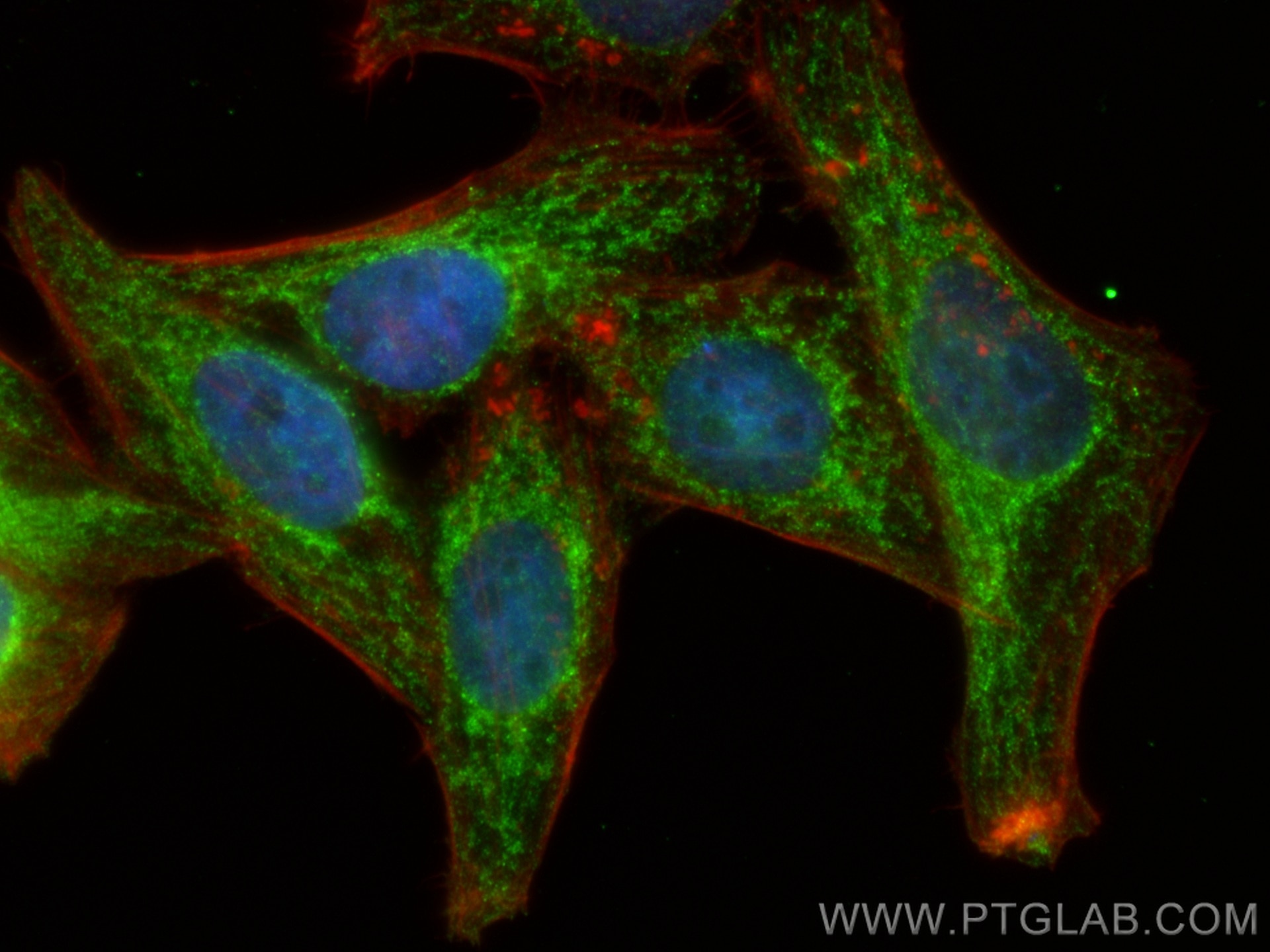 IF Staining of HepG2 using 67487-1-Ig