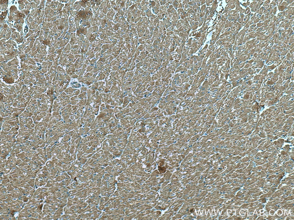 Immunohistochemistry (IHC) staining of human heart tissue using MFN2 Monoclonal antibody (67487-1-Ig)