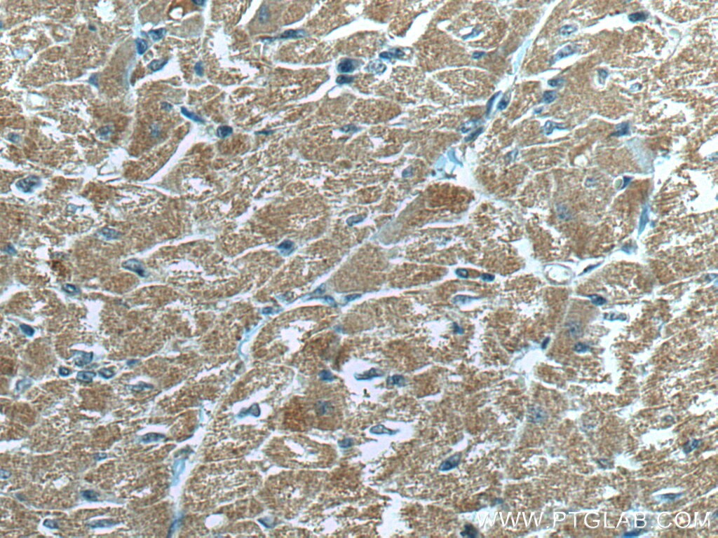 Immunohistochemistry (IHC) staining of human heart tissue using MFN2 Monoclonal antibody (67487-1-Ig)