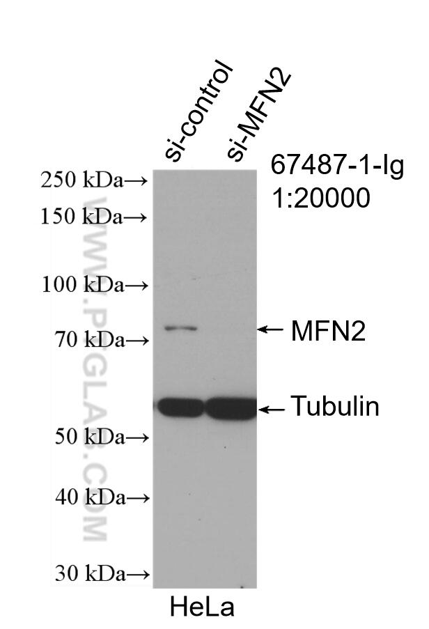 WB analysis of HeLa using 67487-1-Ig