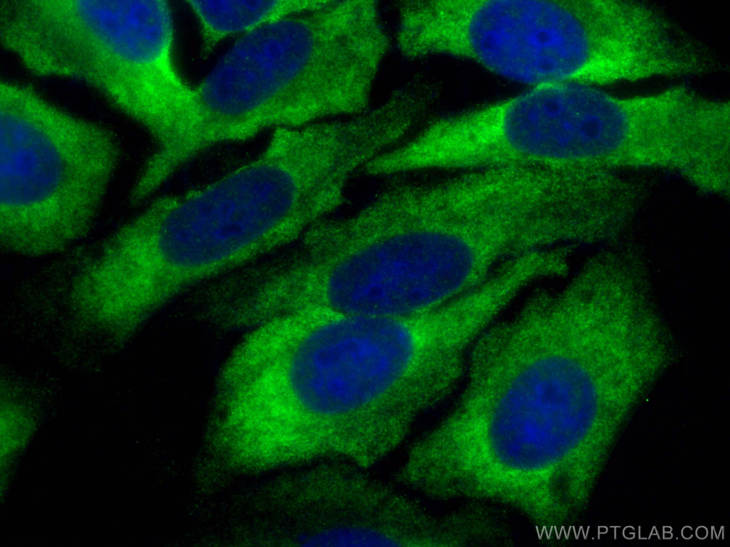 Immunofluorescence (IF) / fluorescent staining of HepG2 cells using MFN2 Recombinant antibody (82673-2-RR)