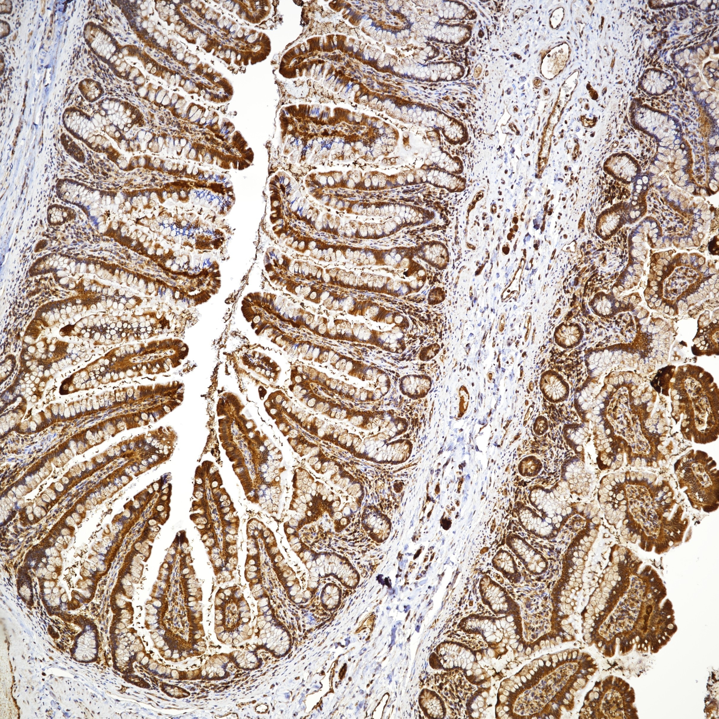 IHC staining of Human Small Bowel Tissue using 82673-2-RR Immunohistochemistry (IHC) staining of Human Small Bowel Tissue using MFN2 Recombinant monoclonal antibody (82673-2-RR)