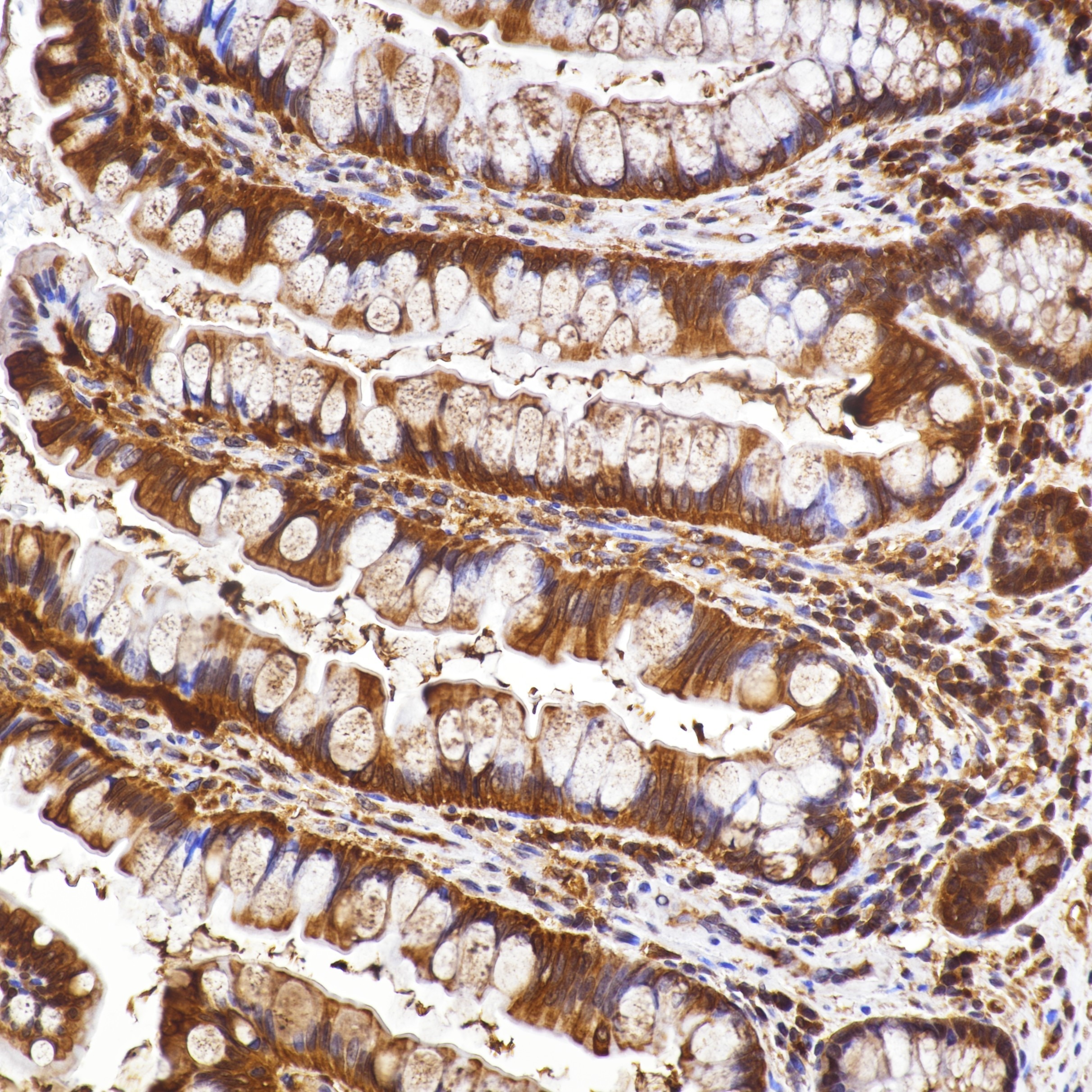 IHC staining of Human Small Bowel Tissue using 82673-2-RR Immunohistochemistry (IHC) staining of Human Small Bowel Tissue using MFN2 Recombinant monoclonal antibody (82673-2-RR)
