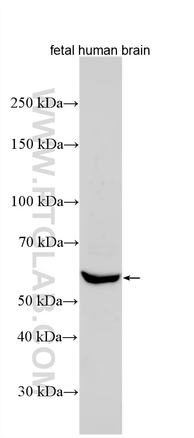 Western Blot (WB) analysis of various lysates using MFRP Polyclonal antibody (31017-1-AP)