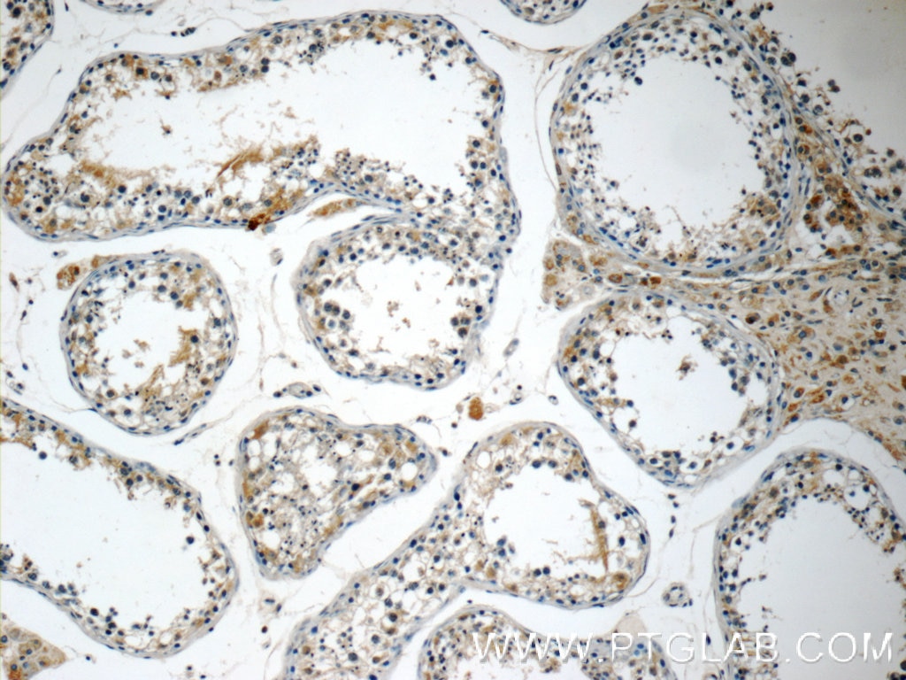Immunohistochemistry (IHC) staining of human testis tissue using MFSD2 Polyclonal antibody (25498-1-AP)