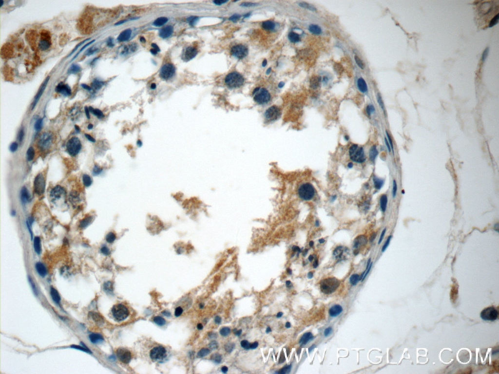 Immunohistochemistry (IHC) staining of human testis tissue using MFSD2 Polyclonal antibody (25498-1-AP)