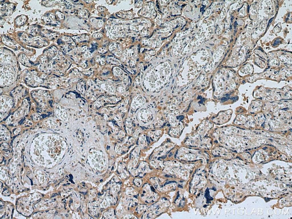 Immunohistochemistry (IHC) staining of human placenta tissue using MFSD2 Polyclonal antibody (25498-1-AP)