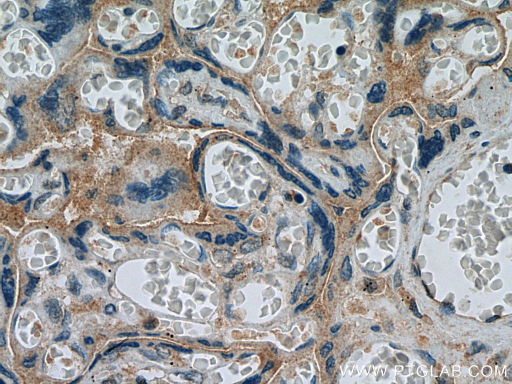 Immunohistochemistry (IHC) staining of human placenta tissue using MFSD2 Polyclonal antibody (25498-1-AP)