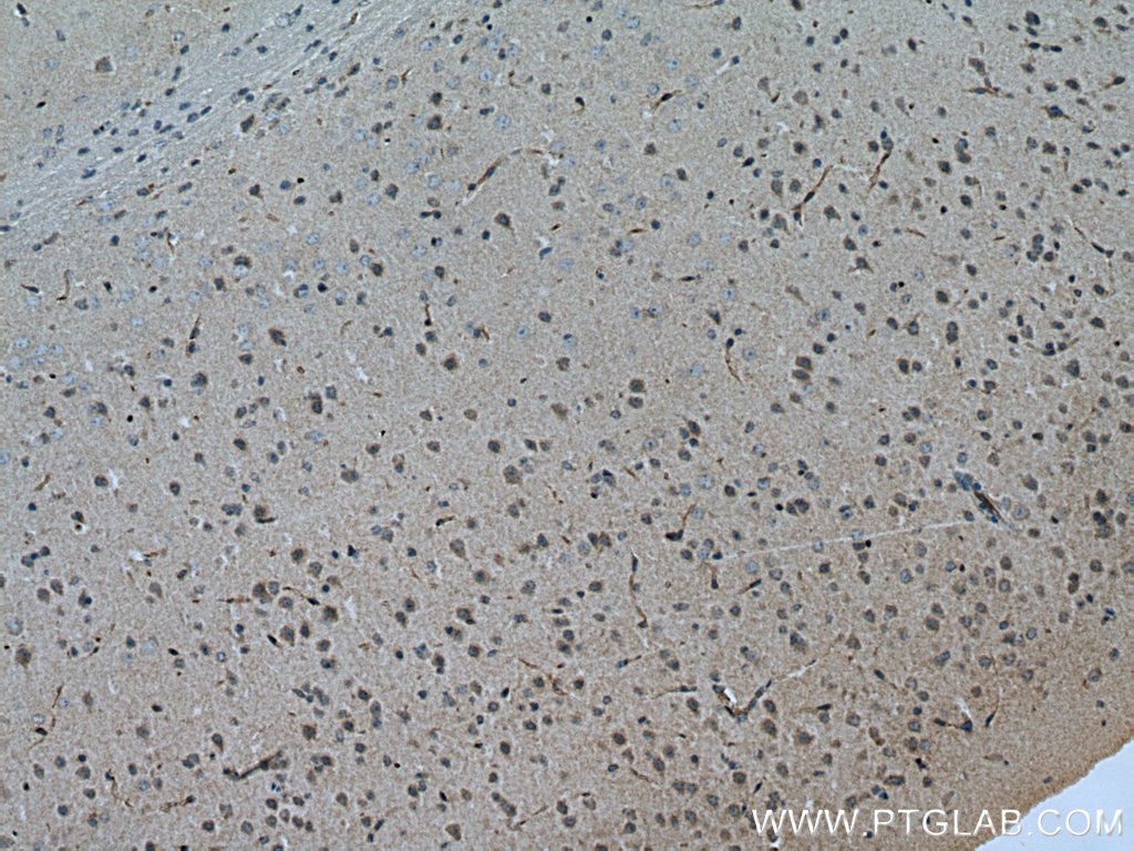 Immunohistochemistry (IHC) staining of mouse brain tissue using MFSD2 Polyclonal antibody (25498-1-AP)