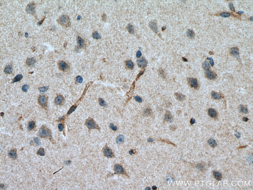 Immunohistochemistry (IHC) staining of mouse brain tissue using MFSD2 Polyclonal antibody (25498-1-AP)