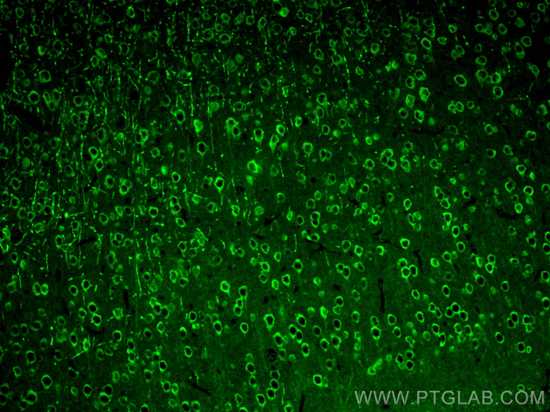 Immunofluorescence (IF) / fluorescent staining of mouse brain tissue using MFSD2 Polyclonal antibody (30555-1-AP)