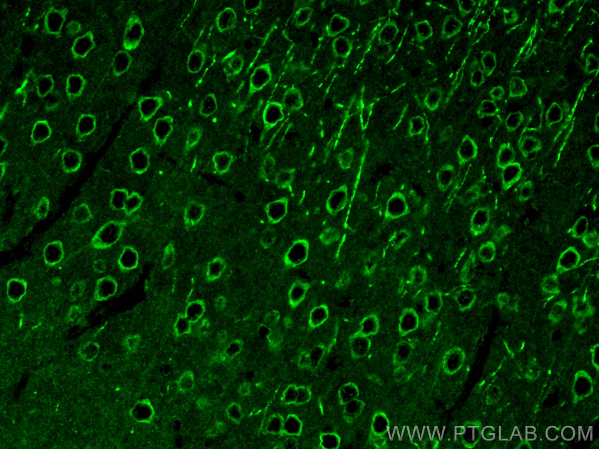 Immunofluorescence (IF) / fluorescent staining of mouse brain tissue using MFSD2 Polyclonal antibody (30555-1-AP)
