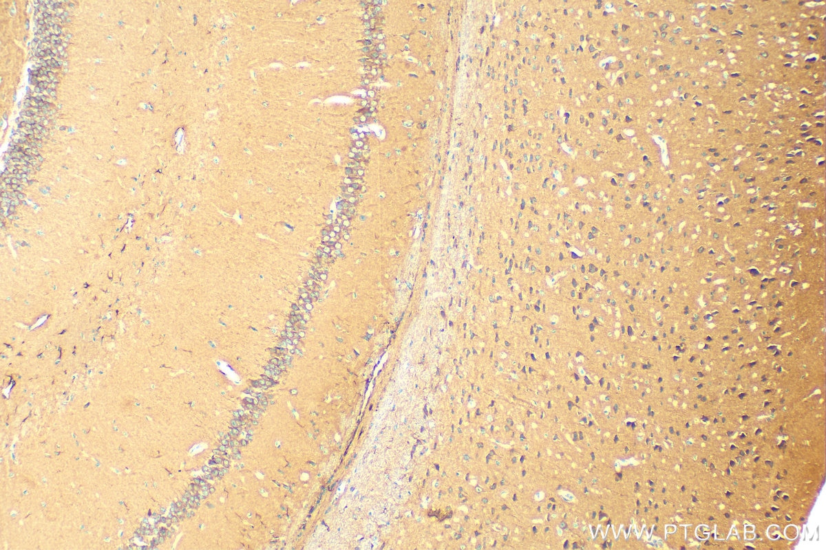 Immunohistochemistry (IHC) staining of mouse brain tissue using MFSD2 Polyclonal antibody (30555-1-AP)