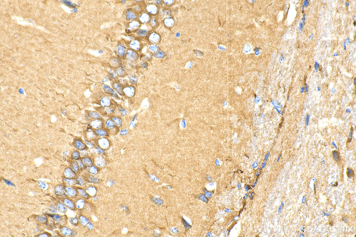 Immunohistochemistry (IHC) staining of mouse brain tissue using MFSD2 Polyclonal antibody (30555-1-AP)