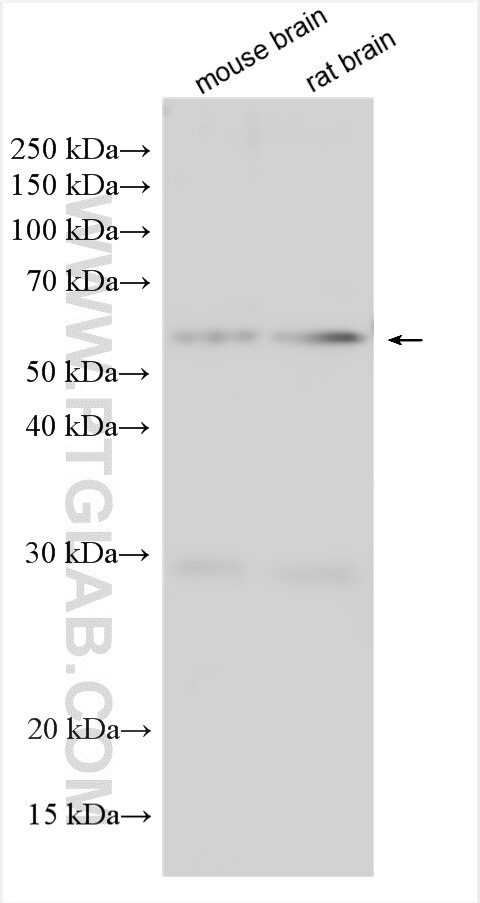 Western Blot (WB) analysis of various lysates using MFSD2 Polyclonal antibody (30555-1-AP)