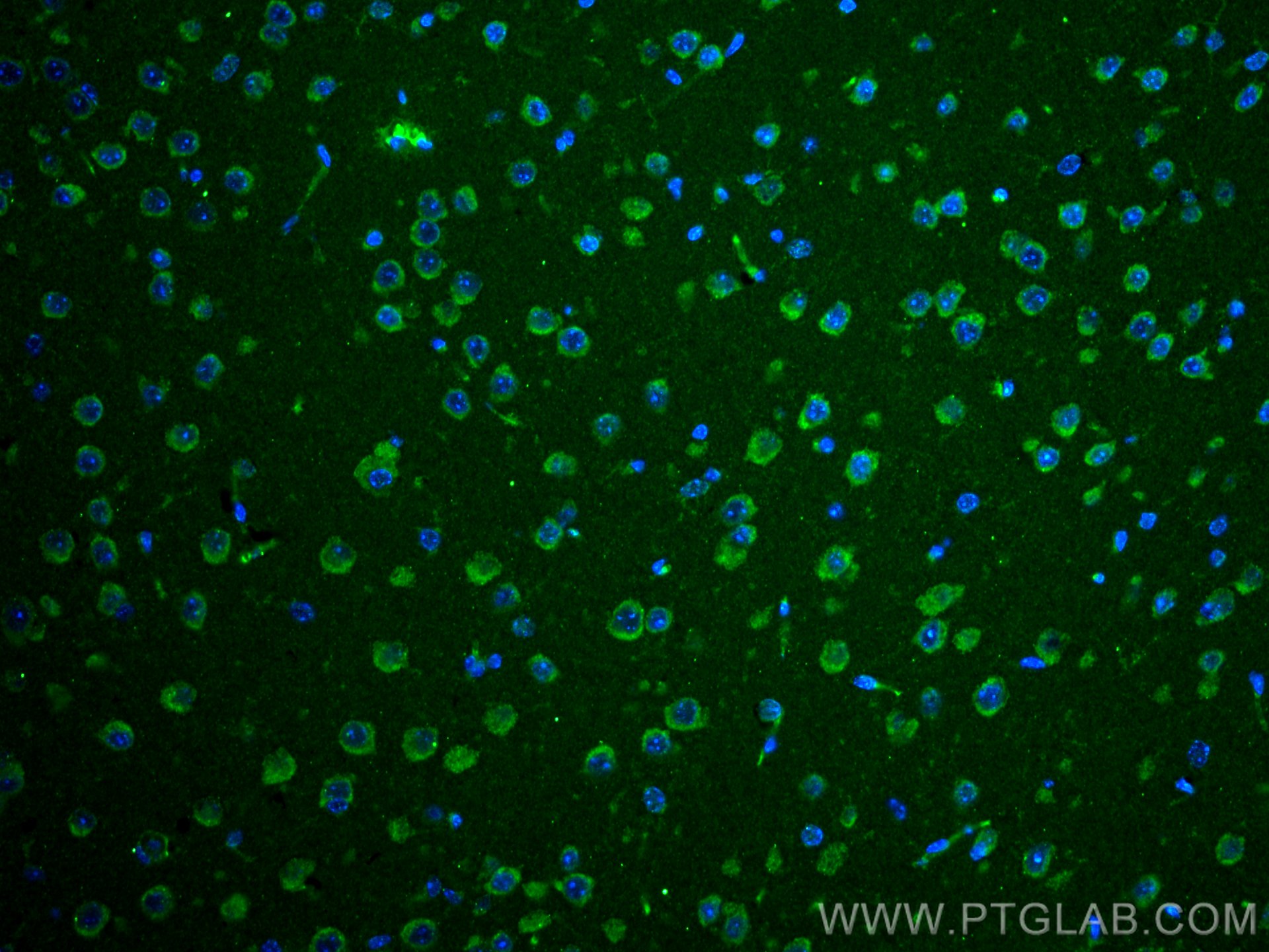 Immunofluorescence (IF) / fluorescent staining of mouse brain tissue using MFSD2 Monoclonal antibody (67965-1-Ig)
