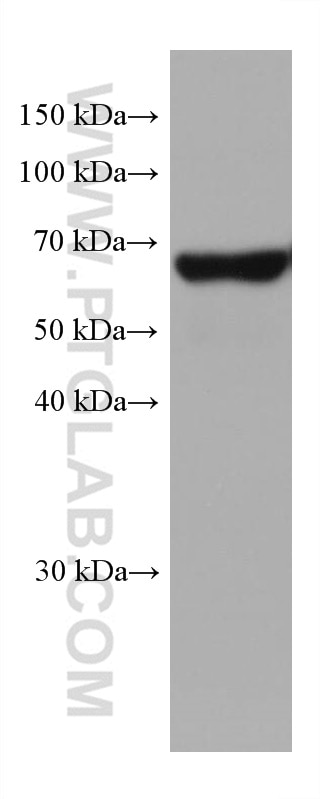 Western Blot (WB) analysis of human placenta tissue using MFSD2 Monoclonal antibody (67965-1-Ig)