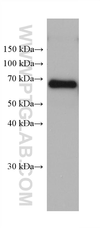 Western Blot (WB) analysis of human placenta tissue using MFSD2 Monoclonal antibody (67965-1-Ig)