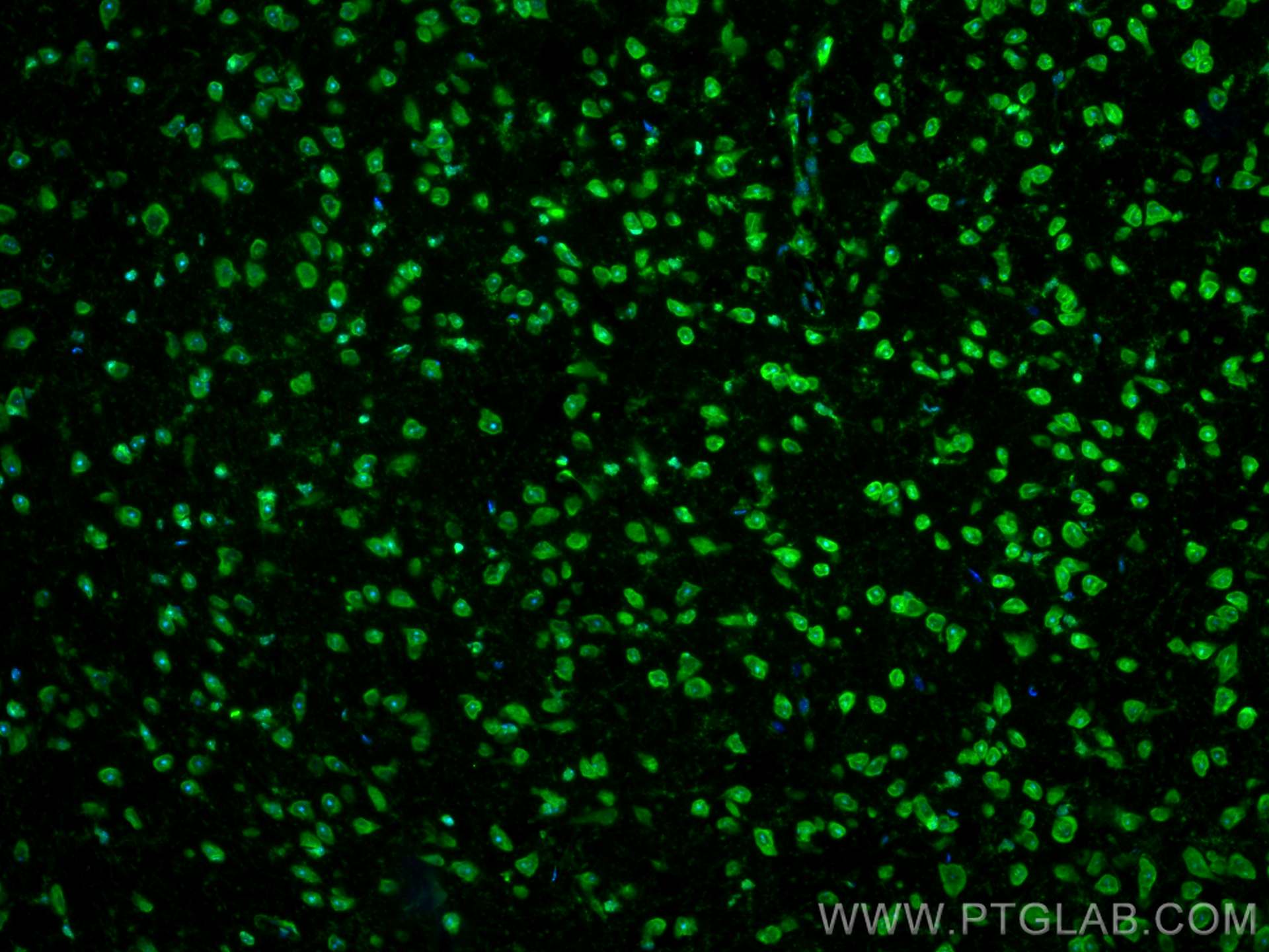 Immunofluorescence (IF) / fluorescent staining of mouse brain tissue using CoraLite® Plus 488-conjugated MFSD2 Monoclonal ant (CL488-67965)