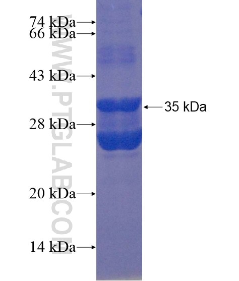 MFSD2 fusion protein Ag22232 SDS-PAGE