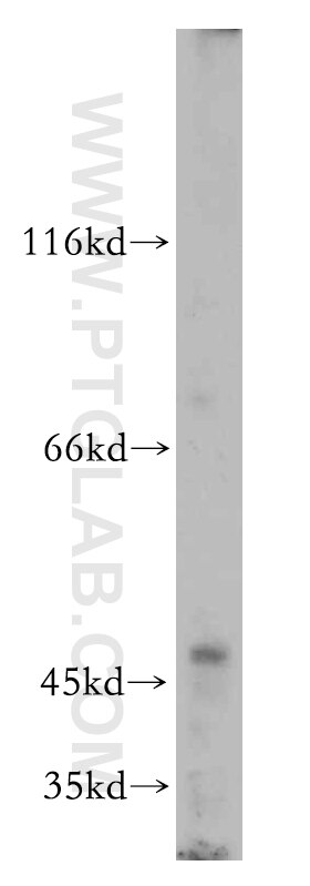 Western Blot (WB) analysis of MCF-7 cells using MFSD7 Polyclonal antibody (21037-1-AP)