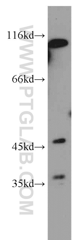 Western Blot (WB) analysis of MCF-7 cells using MFSD7 Polyclonal antibody (21037-1-AP)