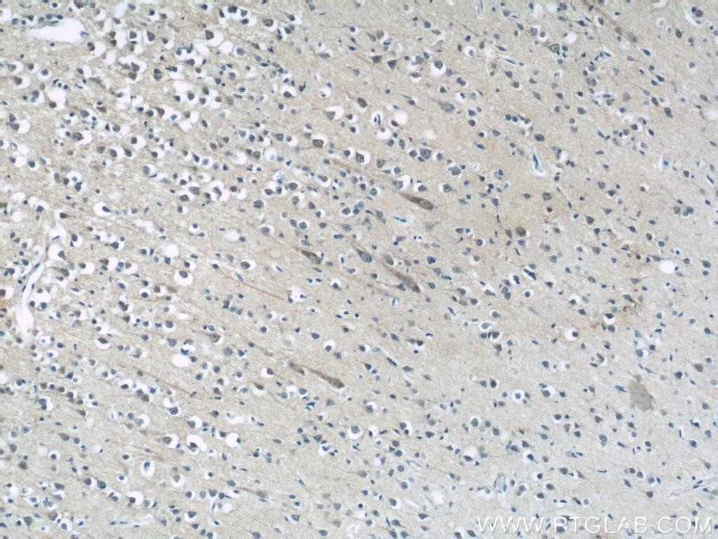 Immunohistochemistry (IHC) staining of human brain tissue using MFSD8 Polyclonal antibody (24298-1-AP)