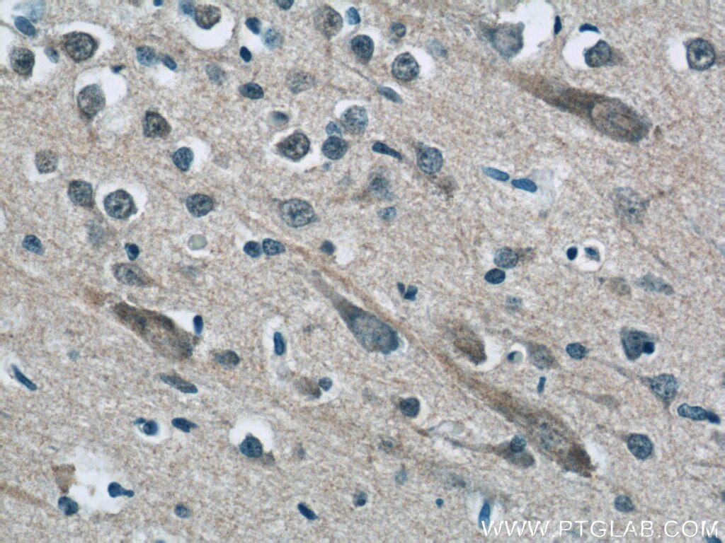 Immunohistochemistry (IHC) staining of human brain tissue using MFSD8 Polyclonal antibody (24298-1-AP)