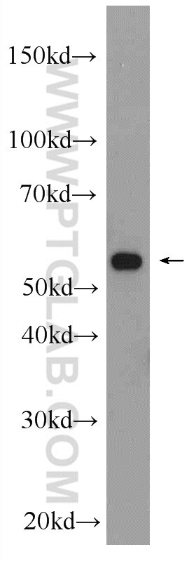 Western Blot (WB) analysis of mouse liver tissue using MFSD8 Polyclonal antibody (24298-1-AP)