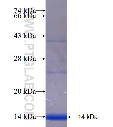 MFSD8 fusion protein Ag18086 SDS-PAGE