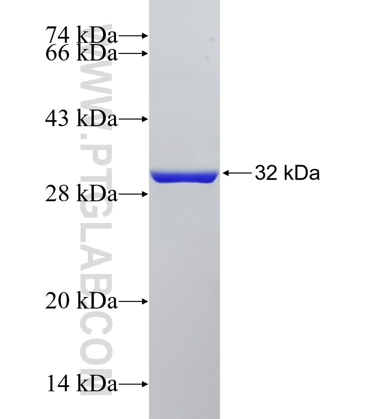 MFSD8 fusion protein Ag18487 SDS-PAGE