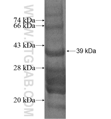 MFSD9 fusion protein Ag14582 SDS-PAGE