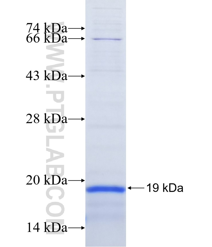 MFSD9 fusion protein Ag15161 SDS-PAGE MFSD9 fusion protein Ag15161 SDS-PAGE