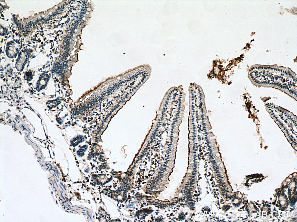 Immunohistochemistry (IHC) staining of mouse small intestine tissue using MGAM Polyclonal antibody (22195-1-AP)