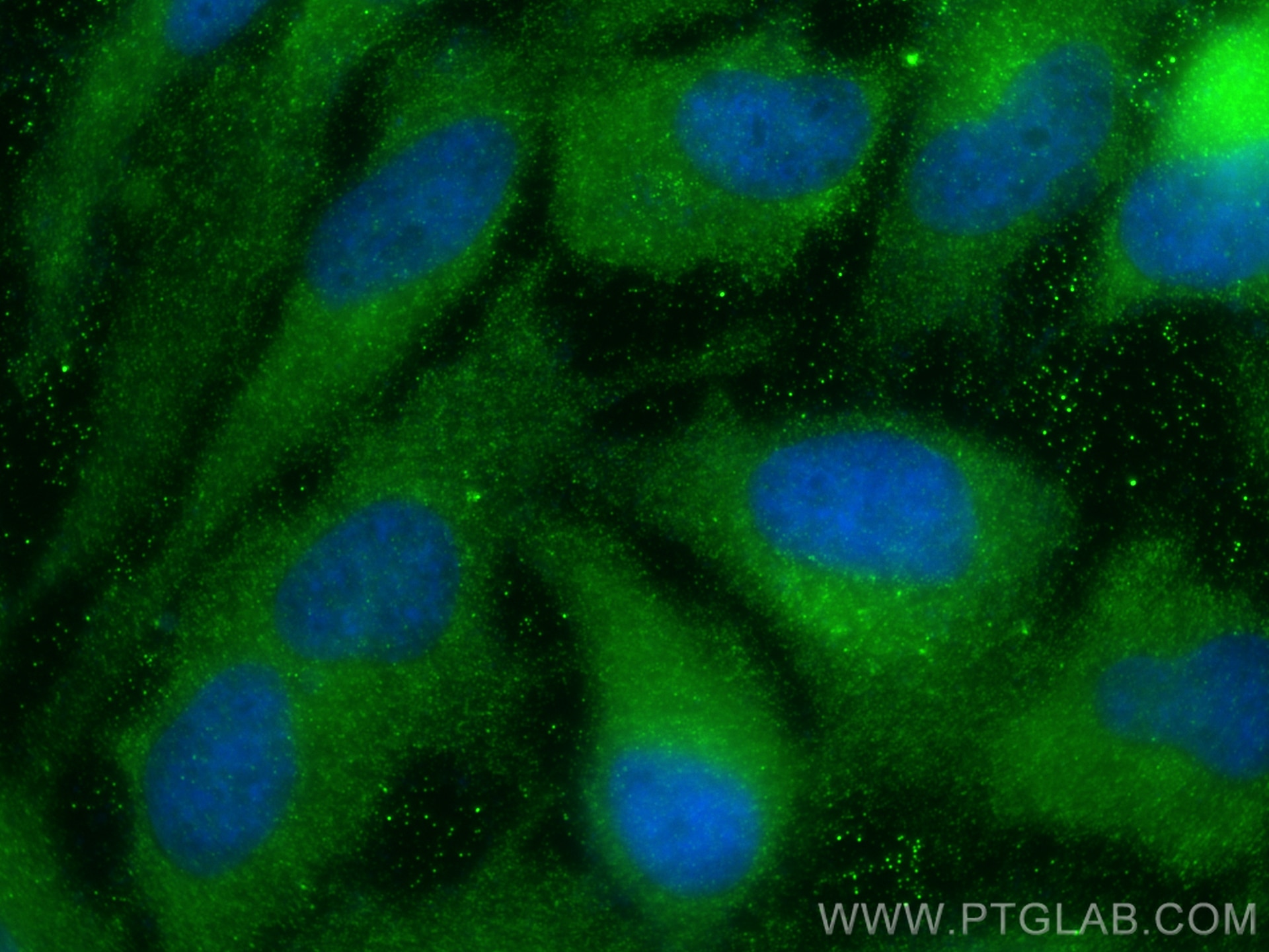 Immunofluorescence (IF) / fluorescent staining of HeLa cells using MGAT1 Polyclonal antibody (15103-1-AP)