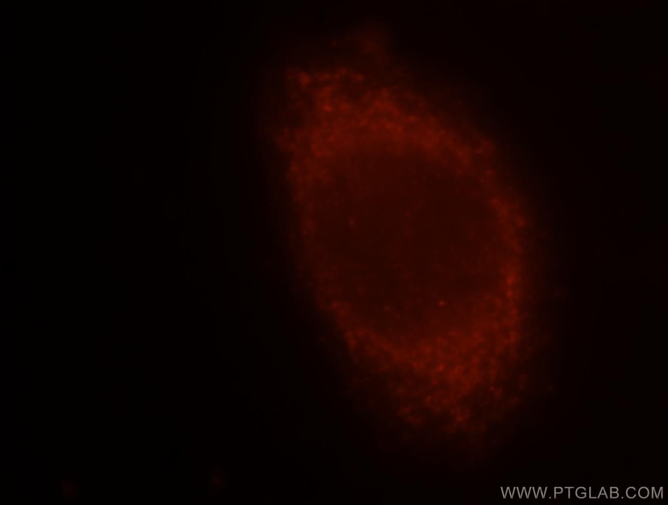 Immunofluorescence (IF) / fluorescent staining of HeLa cells using MGAT1 Polyclonal antibody (15103-1-AP)