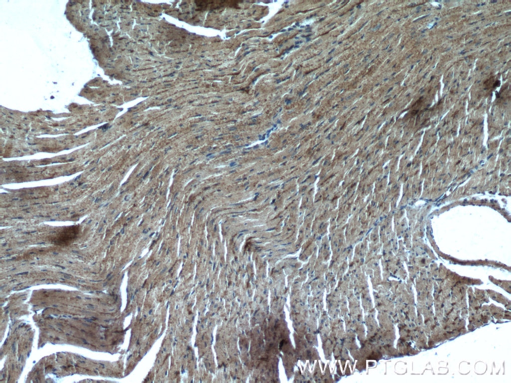 Immunohistochemistry (IHC) staining of mouse heart tissue using MGAT1 Polyclonal antibody (15103-1-AP)