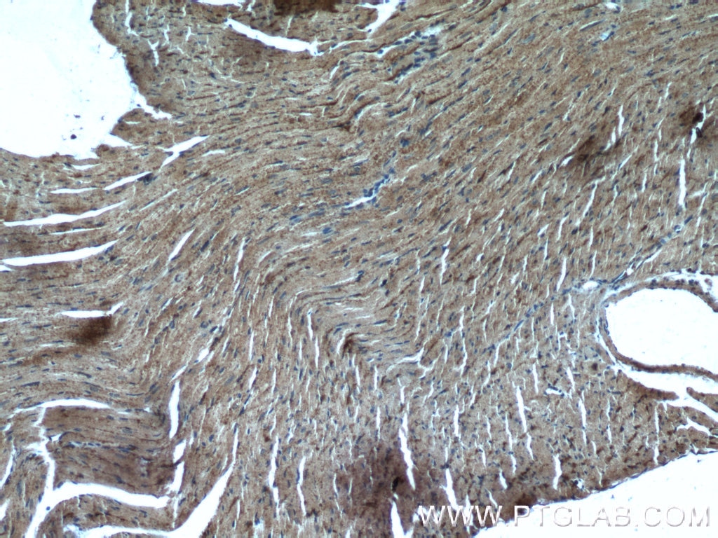 IHC staining of mouse heart using 15103-1-AP