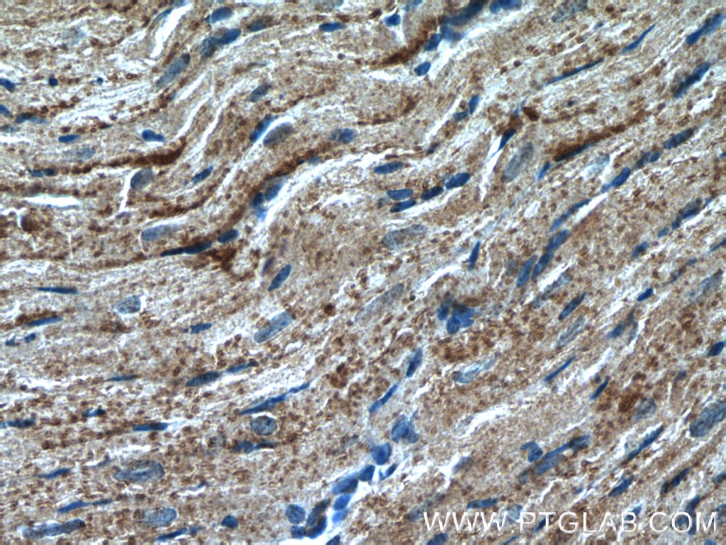 Immunohistochemistry (IHC) staining of mouse heart tissue using MGAT1 Polyclonal antibody (15103-1-AP)