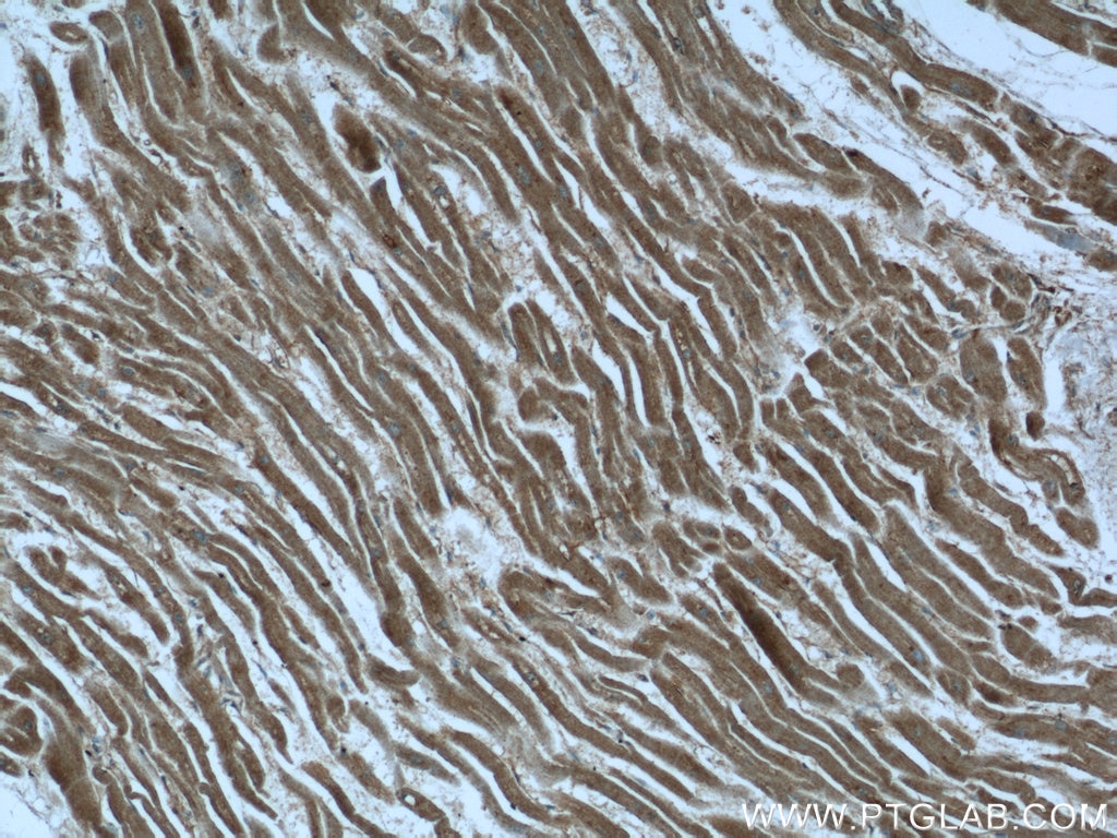 Immunohistochemistry (IHC) staining of human heart tissue using MGAT1 Polyclonal antibody (15103-1-AP)