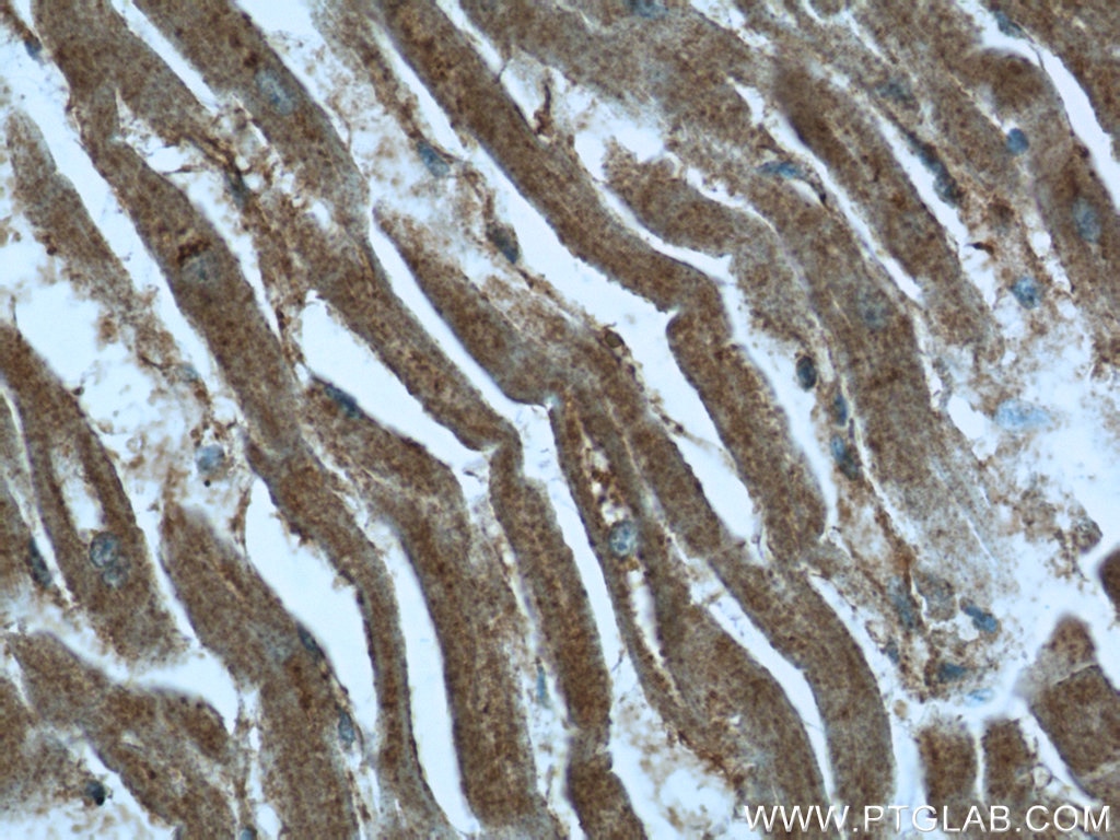 Immunohistochemistry (IHC) staining of human heart tissue using MGAT1 Polyclonal antibody (15103-1-AP)