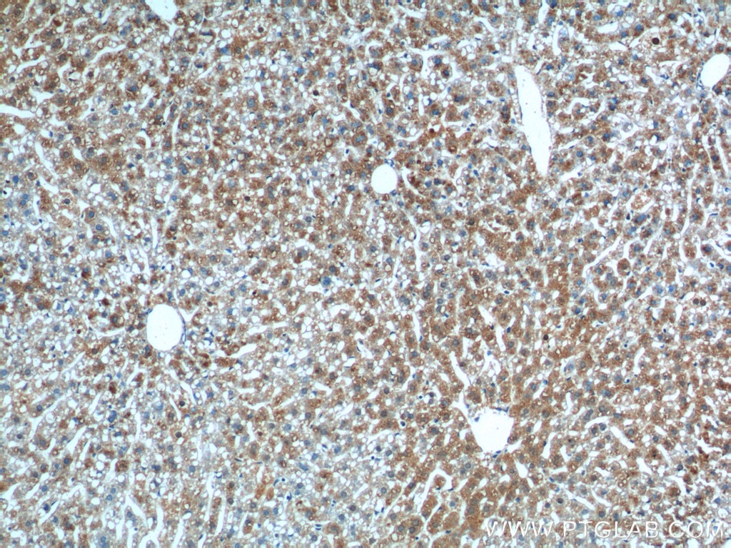 Immunohistochemistry (IHC) staining of mouse liver tissue using MGAT1 Polyclonal antibody (15103-1-AP)