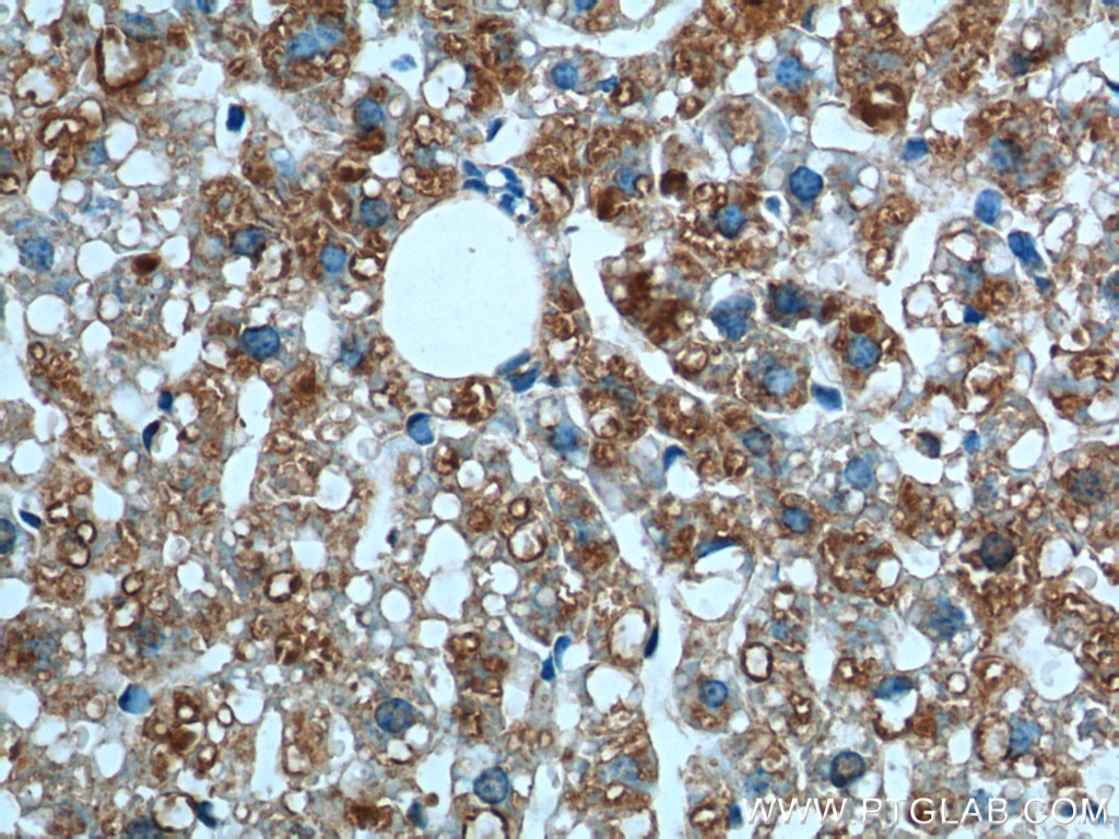 Immunohistochemistry (IHC) staining of mouse liver tissue using MGAT1 Polyclonal antibody (15103-1-AP)