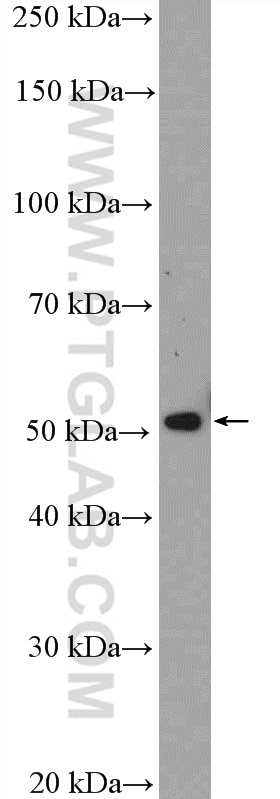 WB analysis of HepG2 using 15103-1-AP