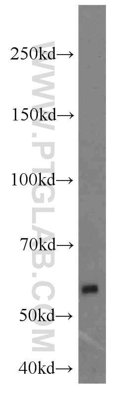 Western Blot (WB) analysis of Y79 cells using MGAT1 Polyclonal antibody (15103-1-AP)