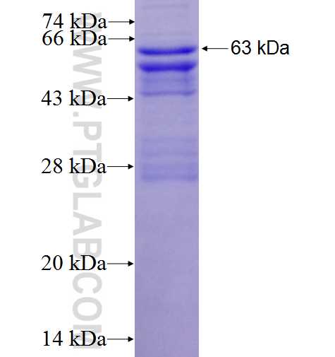 MGAT1 fusion protein Ag7446 SDS-PAGE