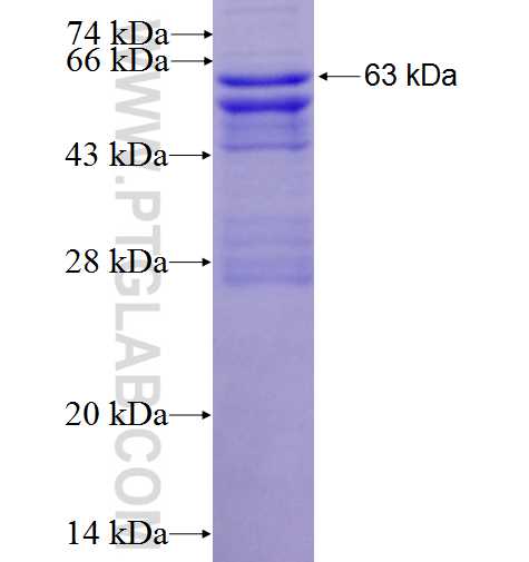 MGAT1 fusion protein Ag7446 SDS-PAGE
